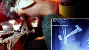 Doktorlar bile şok oldu... Hastaneye bu halde getirildi