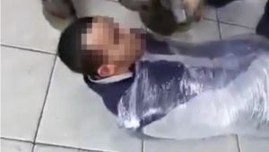 Streç filmle eziyet edilen engelli çocuğun annesinden isyan