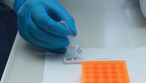 Koronavirüse karşı 15 dakikada sonuç alınabilecek tanı kitleri uygulanmaya başlandı