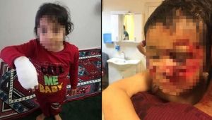 O ilde dehşet! 6 çocuğu paramparça ettiler!