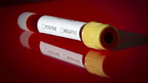 Dünya genelinde Kovid-19'dan iyileşenlerin sayısında son durum