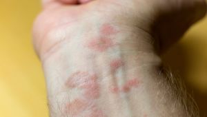 Covid-19 sürecinde egzamaya dikkat