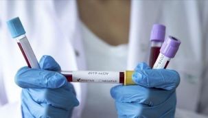 Koronavirüs için yeni test kiti geliştirildi: İşlem süresini yarı yarıya azaltıyor