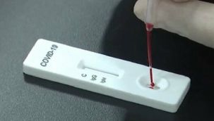 Koronavirüs test kitleri bozuk çıktı, 2 bürokrat görevden alındı!