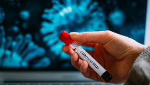 Koronavirüste flaş gelişme: İlaç için tarih verildi!