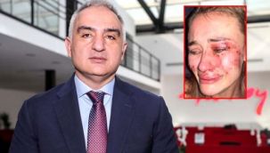Bakan Ersoy Çeşme'deki darp olayı ile ilgili açıklama yaptı: Kimsenin yanına kar kalmayacak!