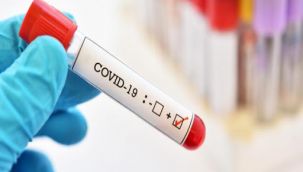 İzmir’in Covid-19 raporu: Toplam vaka ve test sayısı!
