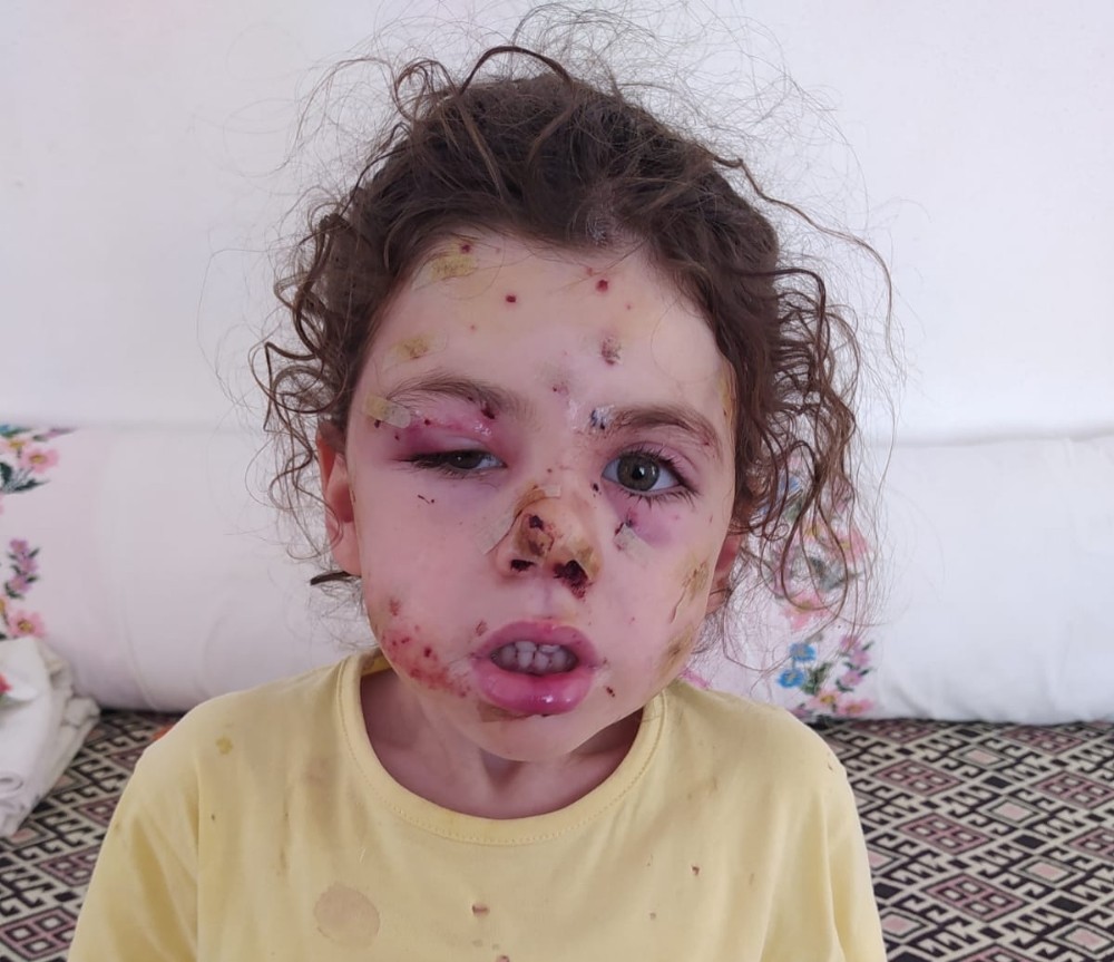 İzmir'de yasak dinlemeyen magandalar 5 yaşındaki Neriman'ı silahla yaraladı