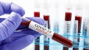 Meclis'e özel PCR test cihazı!