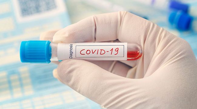 Covid-19 vakalarında 15-49 yaş arasında artış