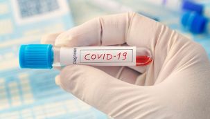 Covid-19 vakalarında 15-49 yaş arasında artış