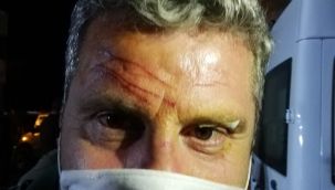 Efes Selçuk'ta CHP'li Meclis üyesine sopalı saldırı!