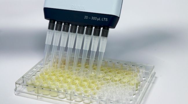 İzmir'de protein bazlı orijinal biyoteknolojik ilaç gelişiminde ilk adım!