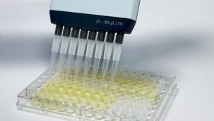İzmir'de protein bazlı orijinal biyoteknolojik ilaç gelişiminde ilk adım!