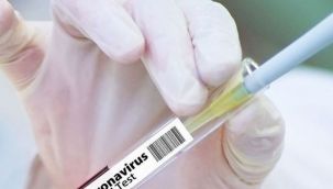 Koronavirüste kritik gelişme: Büyük ilaç firması testleri durdurdu