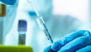 Bakan Varank duyurdu: PCR testlerinde yeni dönem