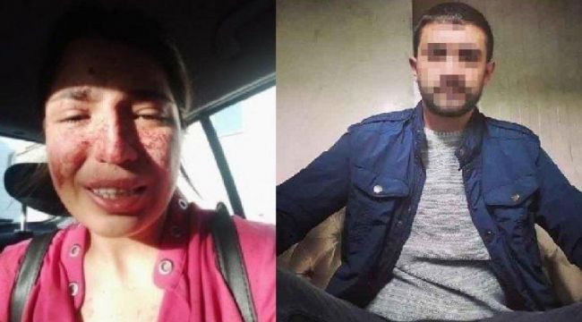 Boşandığı eski eşi tarafından şiddet gören Sibel Aslan: Cinayet haberi olmak istemiyorum