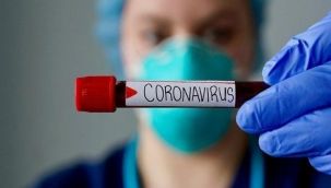 Doktor Mehmet Ceyhan'dan virüsün bitiş tarihiyle ilgili açıklama!