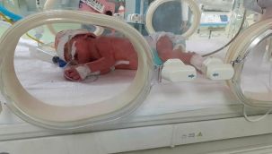 İzmir'de çift rahimli kadın, her bir rahminden birer bebek dünyaya getirdi