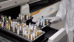 Koronavirüs tanı kitlerinde yeni dönem