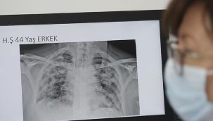 Koronavirüsün en büyük gizemi çözüldü!