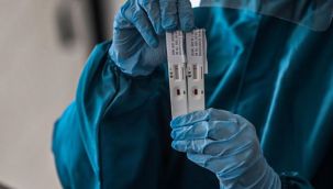Virüse karşı bağışıklığı ölçen yeni test
