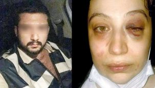 Şiddet mağduru kadın tahliye kararına itiraz etti: Sonraki haberiniz ölümüm!