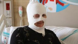 Başından aşağıya çaydanlık dökülen kadın feci şekilde yandı!