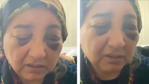 Kocası tarafından darp edilerek 2 gün boyunca aç ve susuz bırakılan kadın yardım istedi, koca tutuklandı