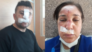 Polis şiddeti hız kesmiyor: 'Aracımızın önünü kesip dövdüler'
