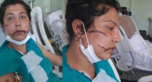 Eşini, bebeğinin yanında bıçakladı