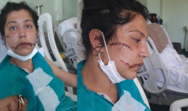 Eşini, bebeğinin yanında bıçakladı