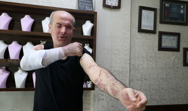 İzmir'de kuyumcuya kezzaplı saldırı