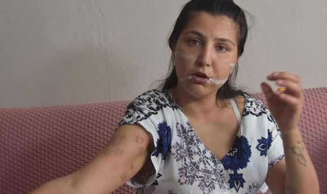 İzmir'de vahşet! 104 yerinden bıçaklayıp başında sigara içti