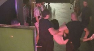 Gittiği mekanda görevlinin parmağını ısırarak kopardı!