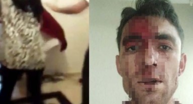 Komşu dehşeti: Kulak memesi kopartıldı, eşi ve çocukları yumruklandı