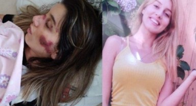 Ters yönden gelen araç, scootera çarptı: 23 yaşındaki hemşirenin durumu ağır!