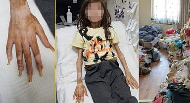Türkiye'nin konuştuğu çocuğun yeni fotoğrafları ortaya çıktı! Dikkat çeken ayrıntı