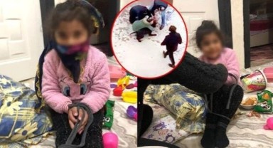 Pitbull saldırısında yaralanan Asiye'nin 'elleri bağlı' görüntüleri tepki çekti