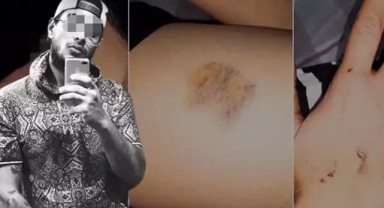 Severek evlendi, 2 ayda cehennemi yaşadı… Sevgi kabusa döndü