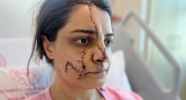 Defalarca şikayet etti, kimse harekete geçmedi! Marmaray İstasyonu'nda saldırıya uğrayan Gülhan Karadereli dehşet anlarını anlattı