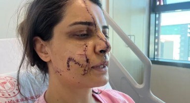 Marmaray'da dehşeti yaşatmıştı. O saldırganın sicili oldukça kirli! Ağaca çıkıp kadınları taciz ediyormuş!