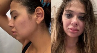 Merve Taşkın gördüğü şiddeti paylaştı: Burnumu yumrukladı, cinsel organıma tekme attı