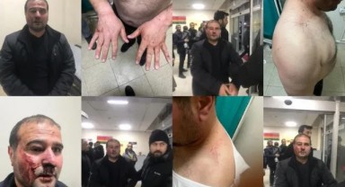 Polis merkezinde feci dayak! Amatör maçta çıkan olaylar sonrası gözaltına kişiye polis merkezinde darbedildi. Valilik soruşturma başlattı