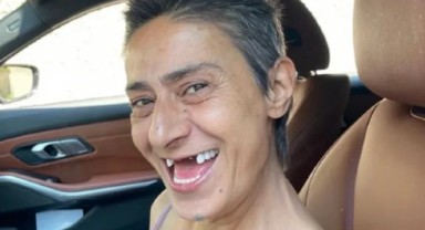 Yıldız Tilbe'nin dişsiz hali gündem olmuştu. Ünlü sanatçının artık dişleri var