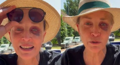Türkiye’ye gelen Sharon Stone kaza geçirdi: Kimse bana bir şey yapmadı