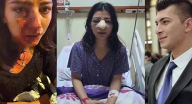 Kırşehir'de genç kızın burnunu kıran AK Partili başkan serbest bırakıldı