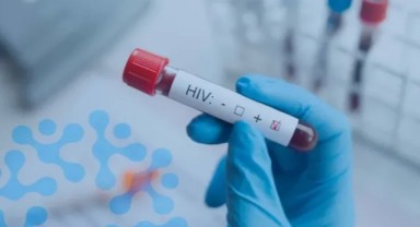 HIV tedavisinde devrim niteliğinde yöntem: 'Hepimizi şaşkına çevirdi'