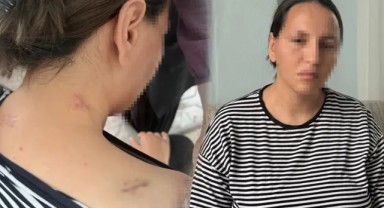 Korumayan Bir Uzaklaştırma Daha... Havva 17 Bıçak Darbesinden 'Ölü Numarası' ile Kurtuldu